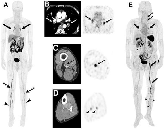 Theranostics Image