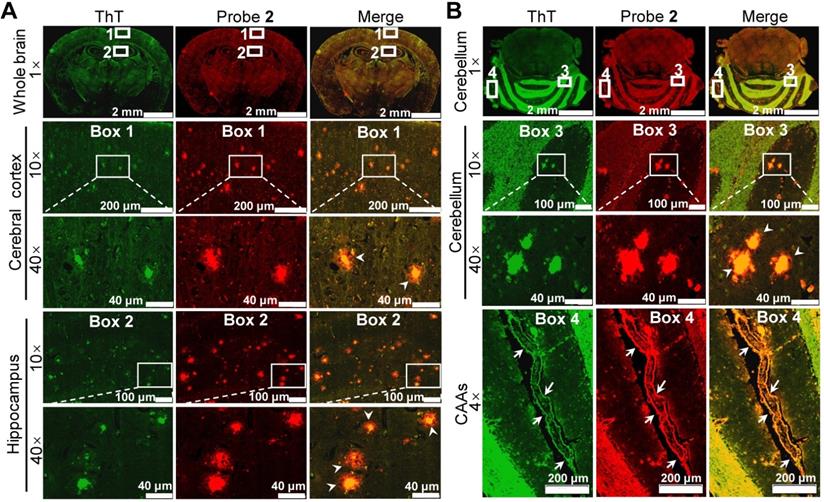 Theranostics Image