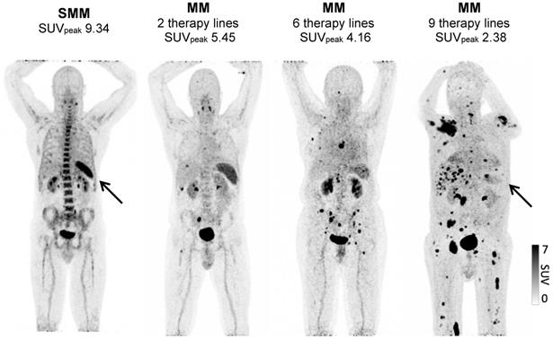 Theranostics Image