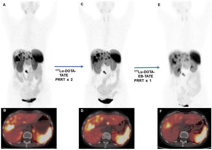 Theranostics Image