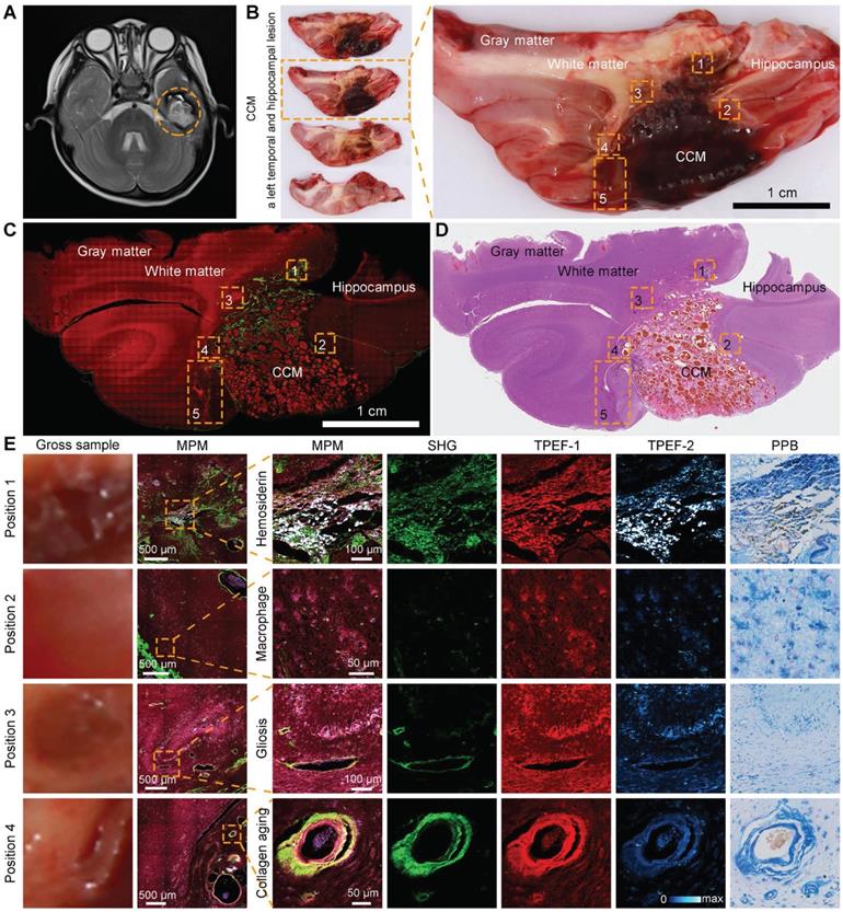 Theranostics Image