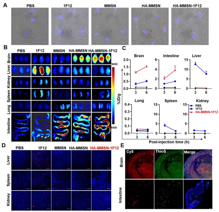 Theranostics Image