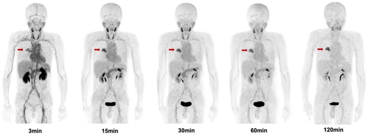 Theranostics Image