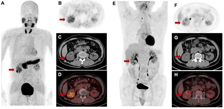 Theranostics Image