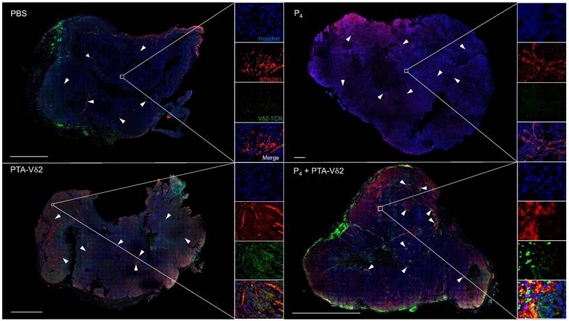 Theranostics Image