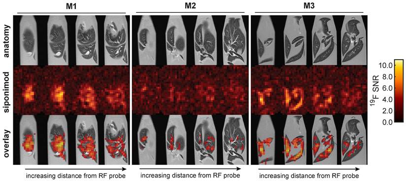 Theranostics Image