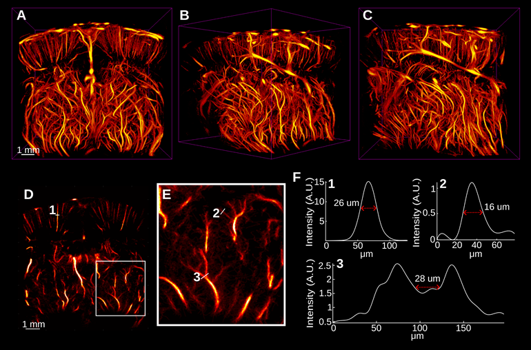 Theranostics Image