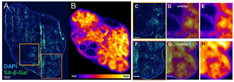 Theranostics Image