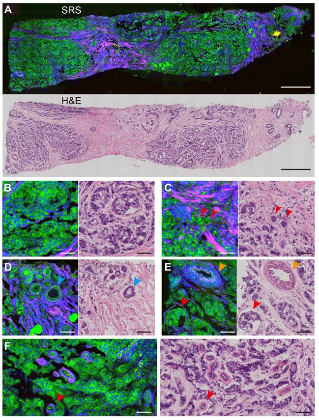 Theranostics Image