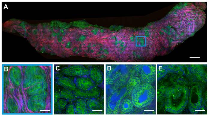 Theranostics Image