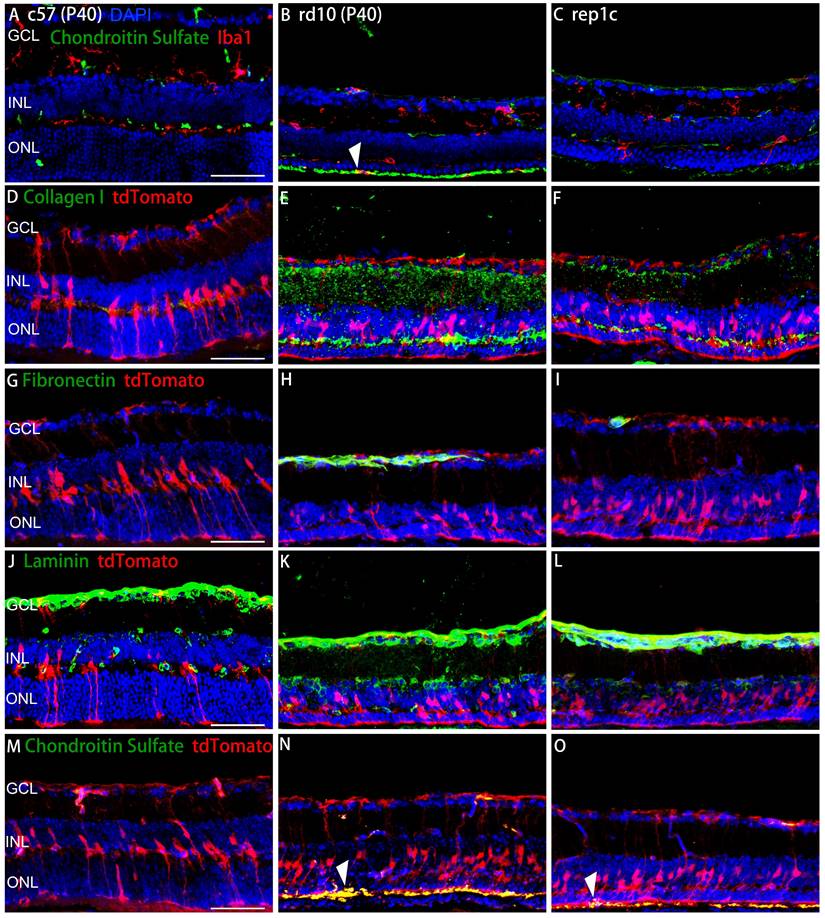 Repopulated retinal microglia promote Müller glia reprogramming and ...