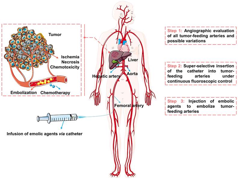 Theranostics Image