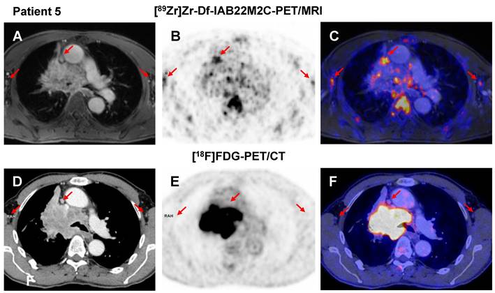 Theranostics Image