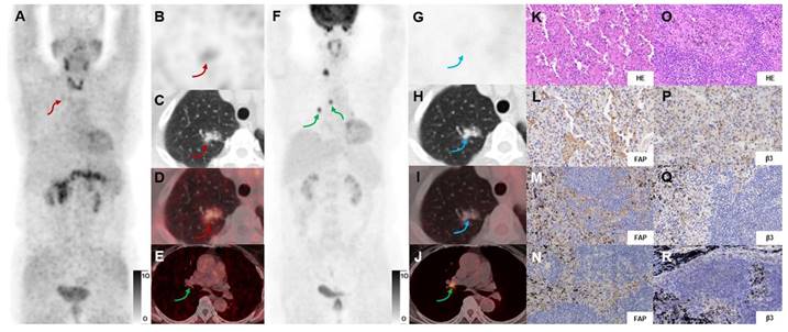 Theranostics Image