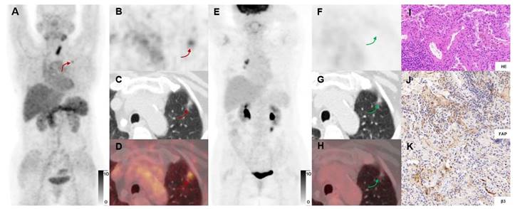 Theranostics Image