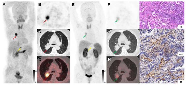 Theranostics Image