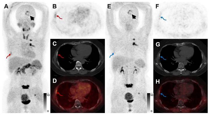 Theranostics Image