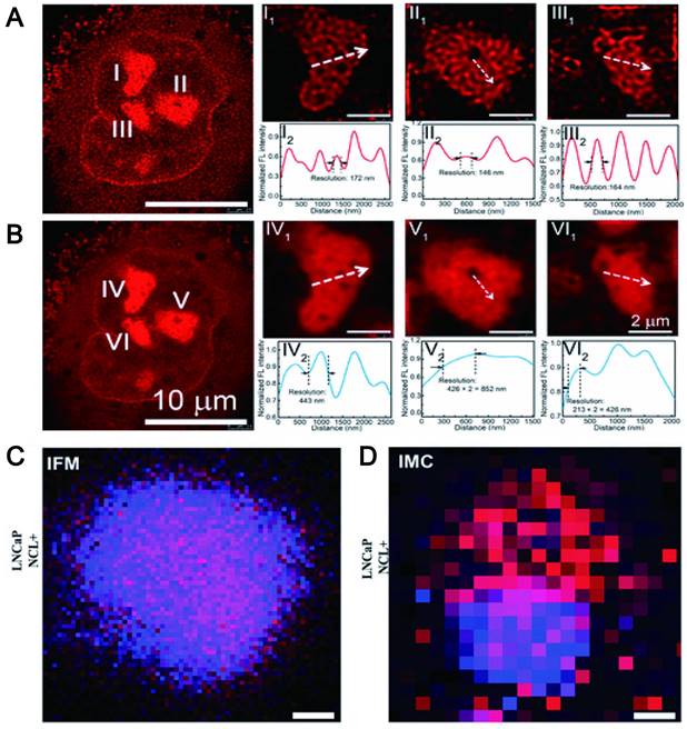 Theranostics Image