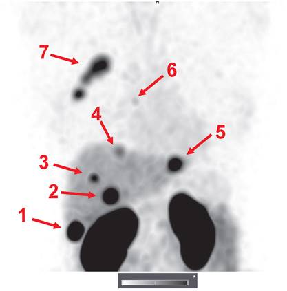 Theranostics Image