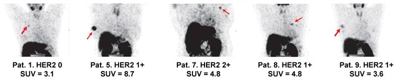 Theranostics Image