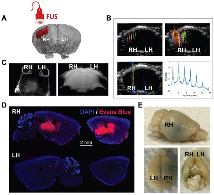 Theranostics Image