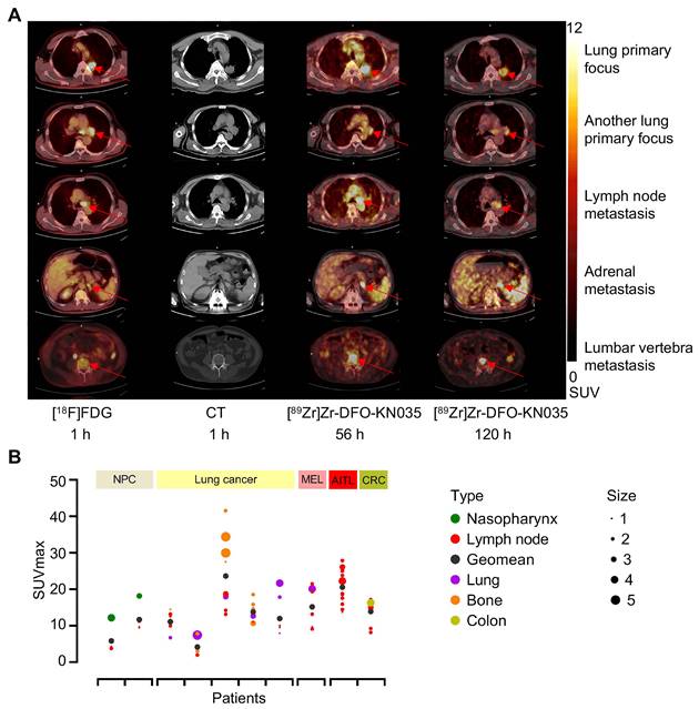 Theranostics Image