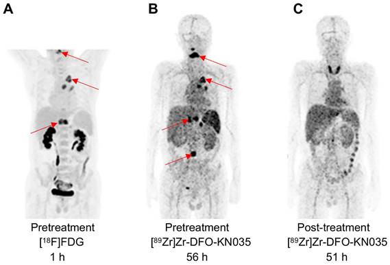 Theranostics Image