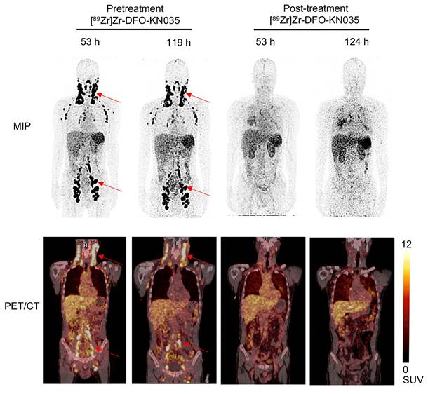 Theranostics Image