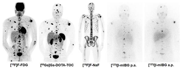 Theranostics Image