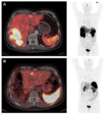 Theranostics Image