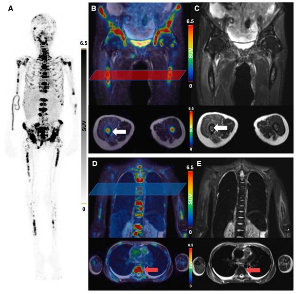 Theranostics Image