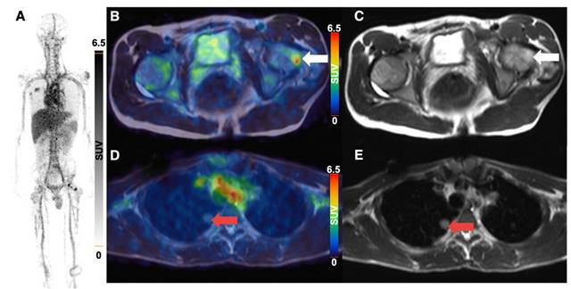 Theranostics Image