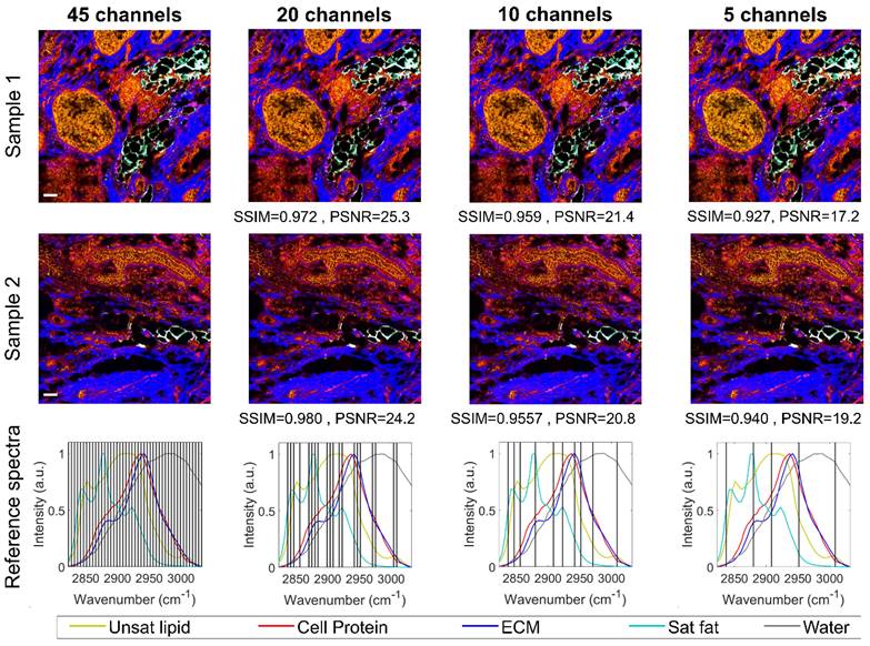 Theranostics Image