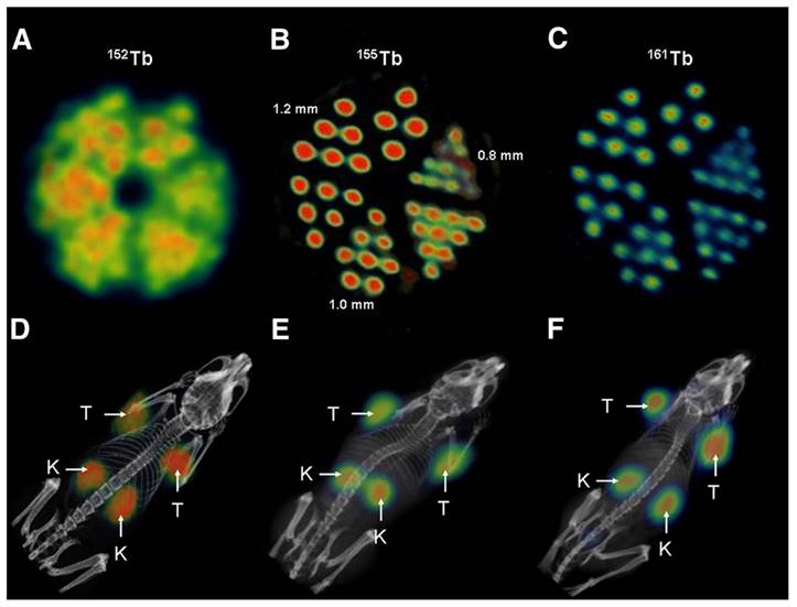 Theranostics Image