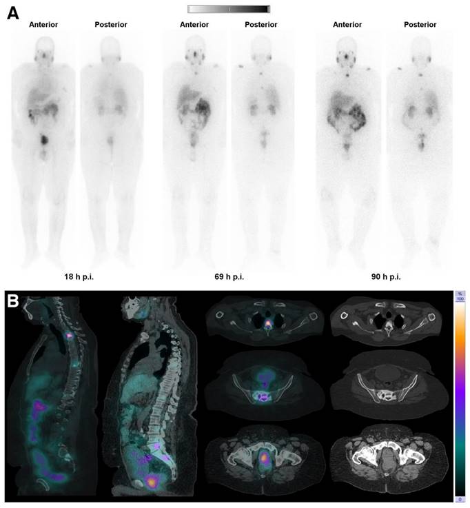 Theranostics Image