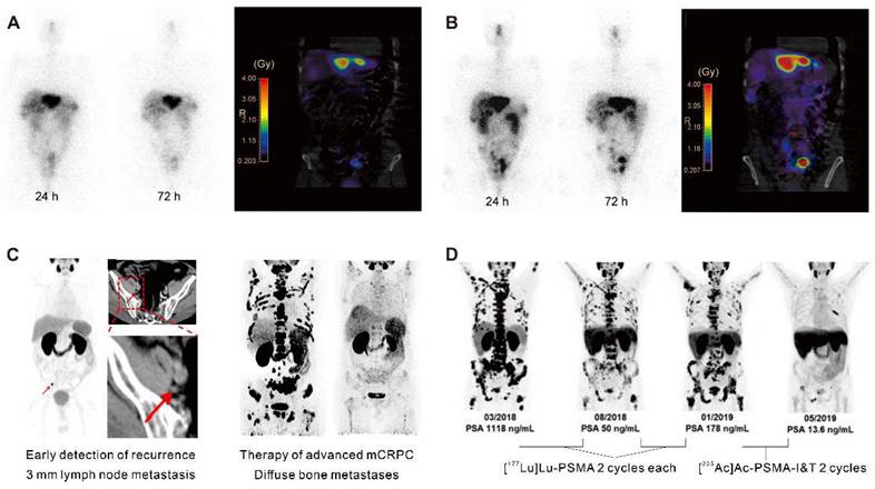 Theranostics Image