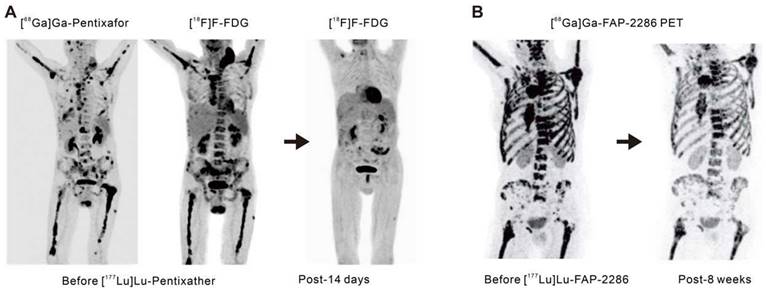 Theranostics Image