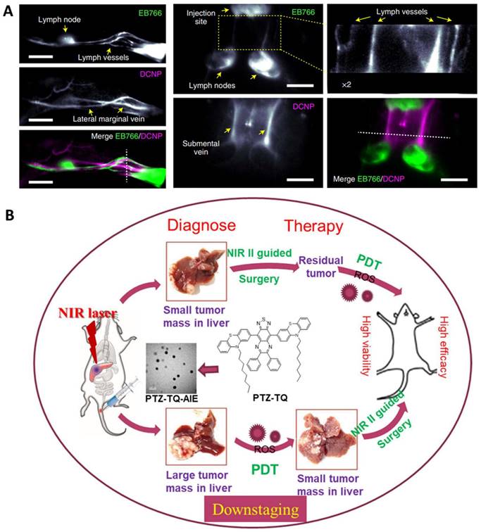 Theranostics Image