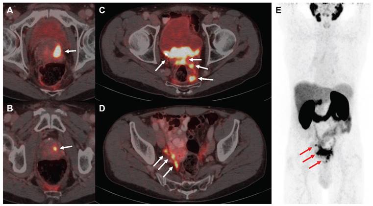 Theranostics Image