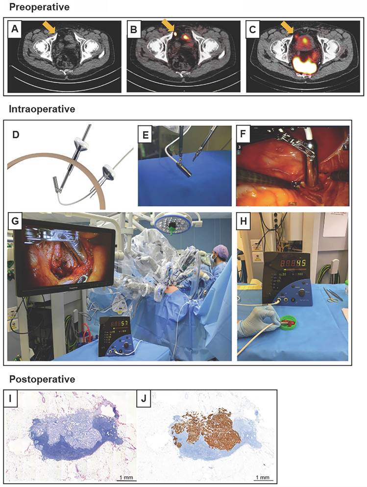 Theranostics Image