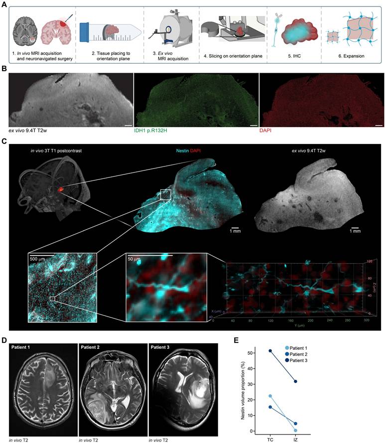 Theranostics Image