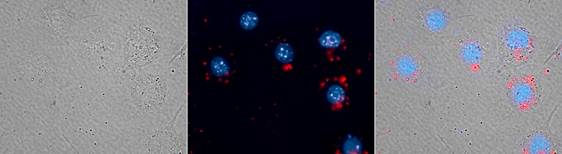 Theranostics Image
