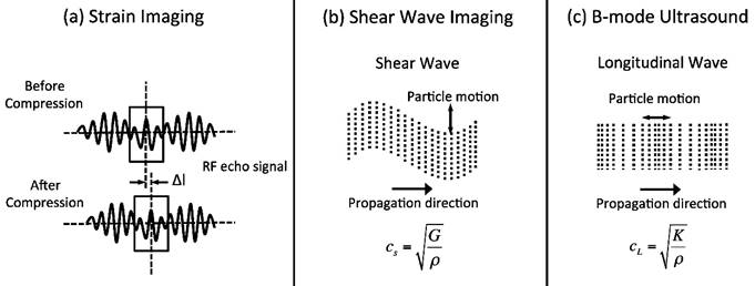 Ultrasonic Shear Wave Velocity Chart