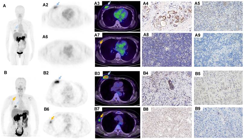 Theranostics Image