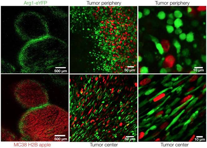 Arg1 expression defines immunosuppressive subsets of tumor-associated