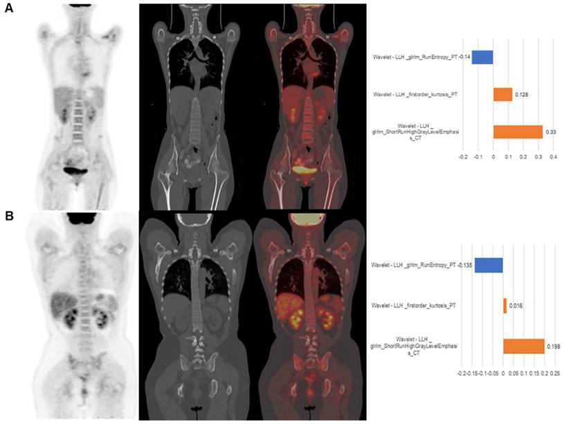 18F-FDG PET/CT Radiomic Analysis with Machine Learning for Identifying ...