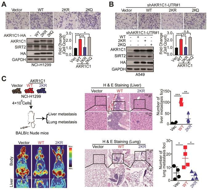 the sirt2-mediated deacetylation of akr1c1 is required for