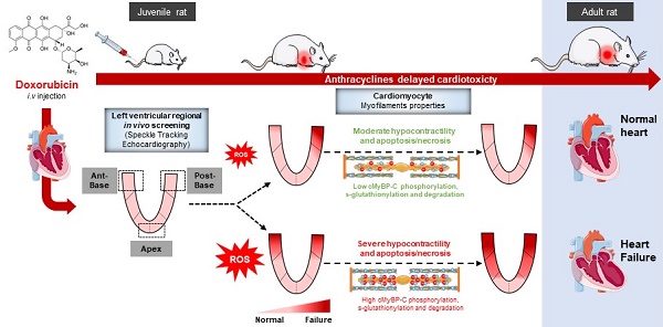 Speckle Tracking Echocardiography: Early Predictor of Diagnosis