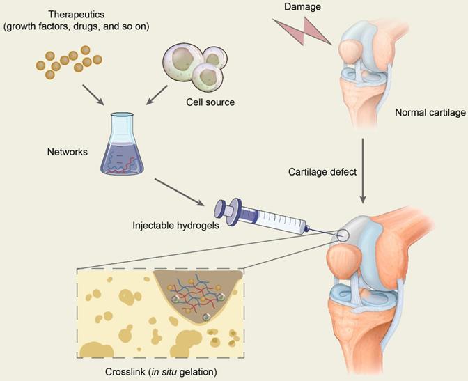 repair knee cartilage naturally