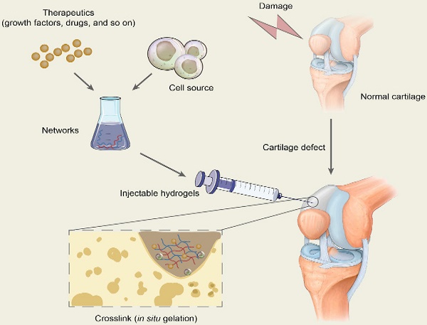 Exquisite design of injectable Hydrogels in Cartilage Repair
